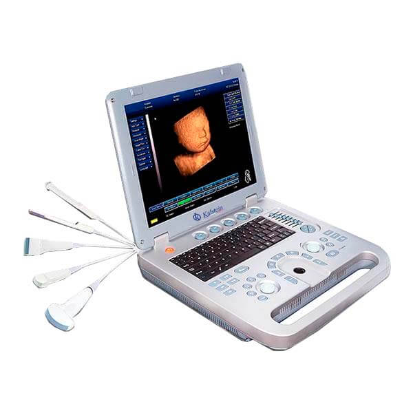Garantía y vida útil esperada del Ultrasonido obstétrico 3D4D GYN YR05147: un plan de reemplazo efectivo