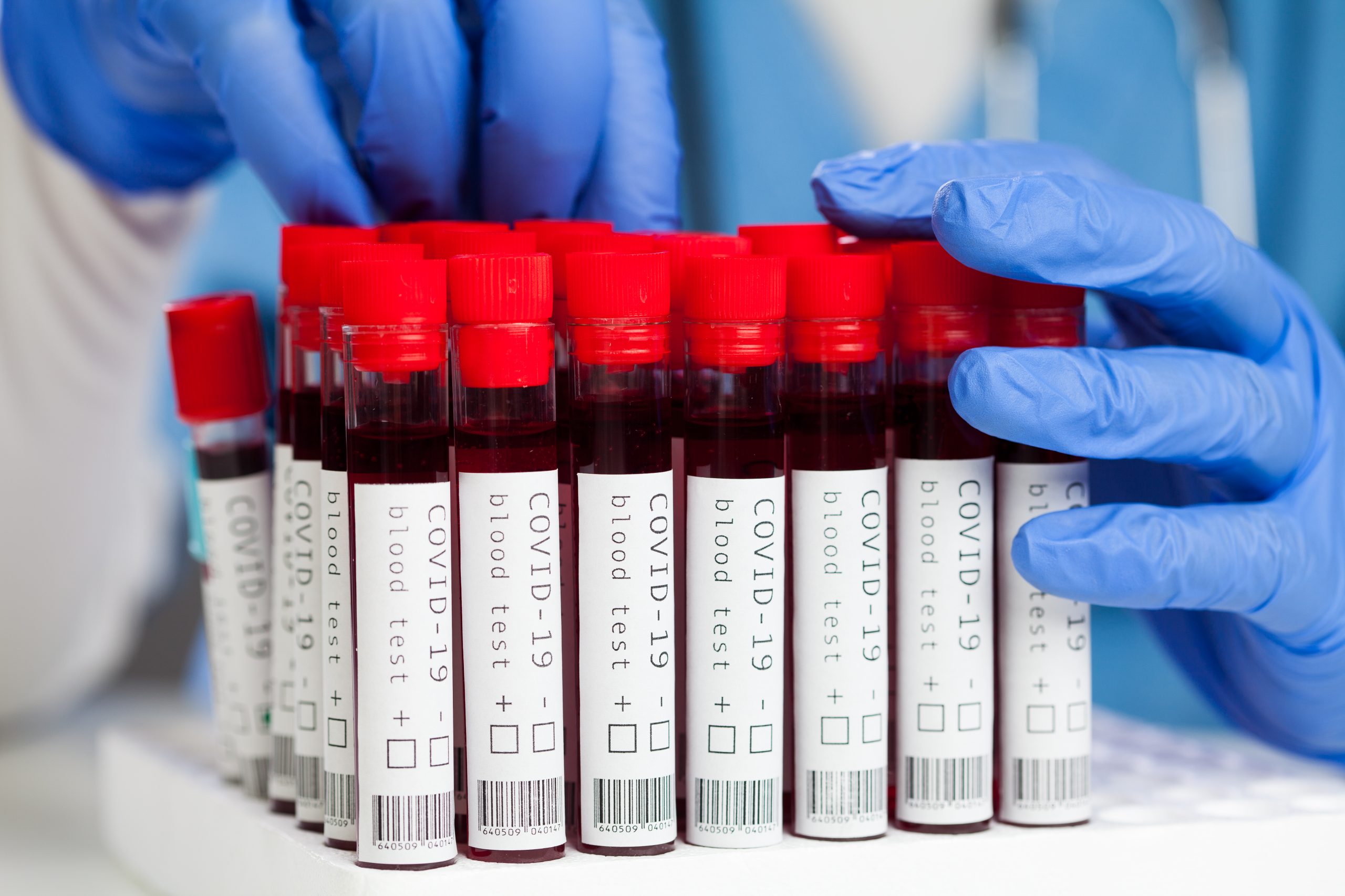 Descubriendo el fascinante mundo de la Hematología: Procedimientos Clave en el Laboratorio Hematológico